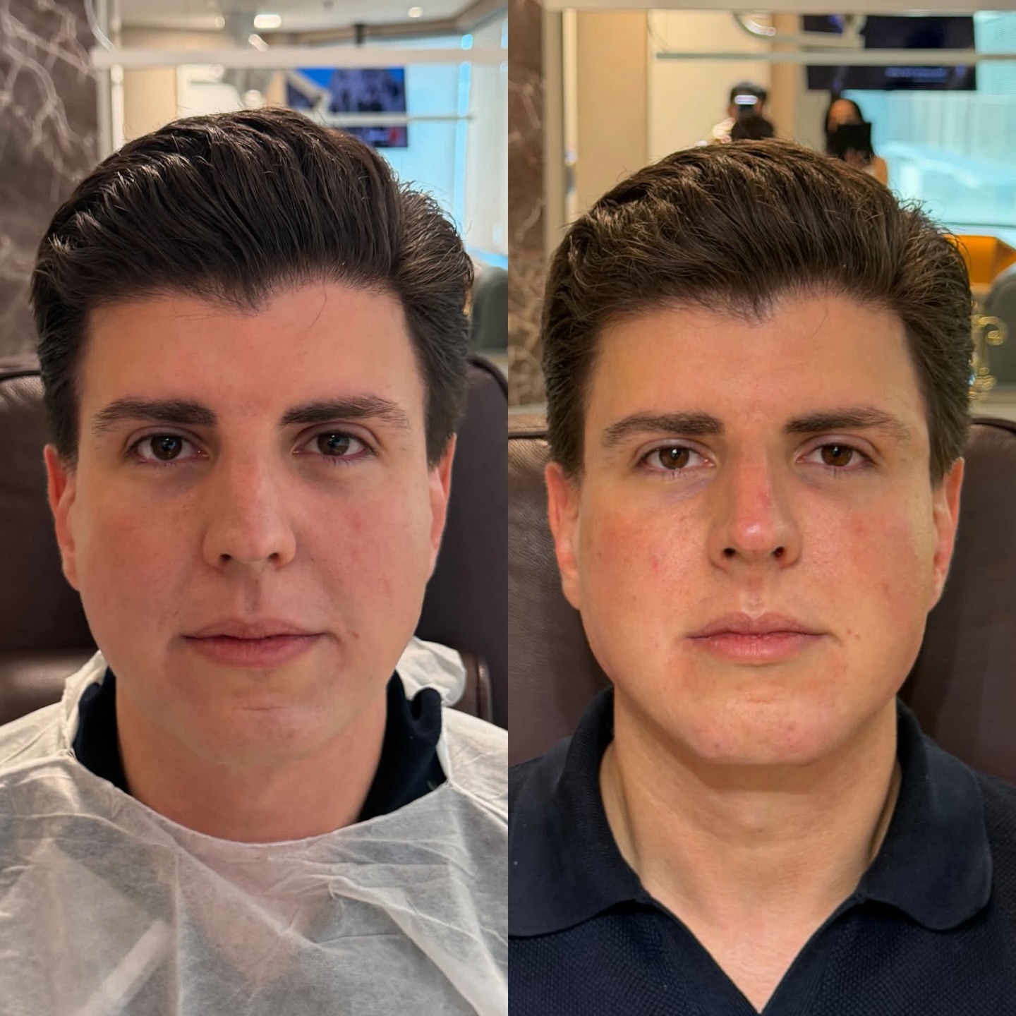 Resultado 2