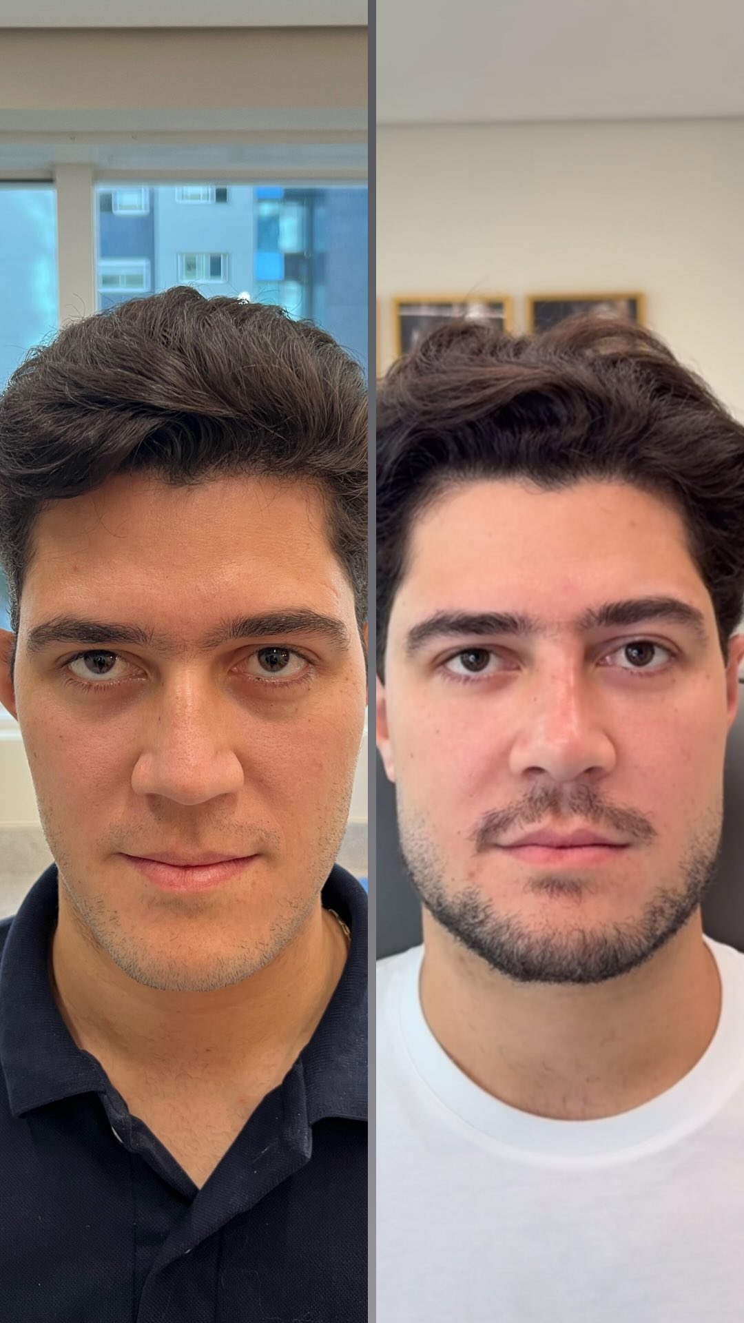 Resultado 1